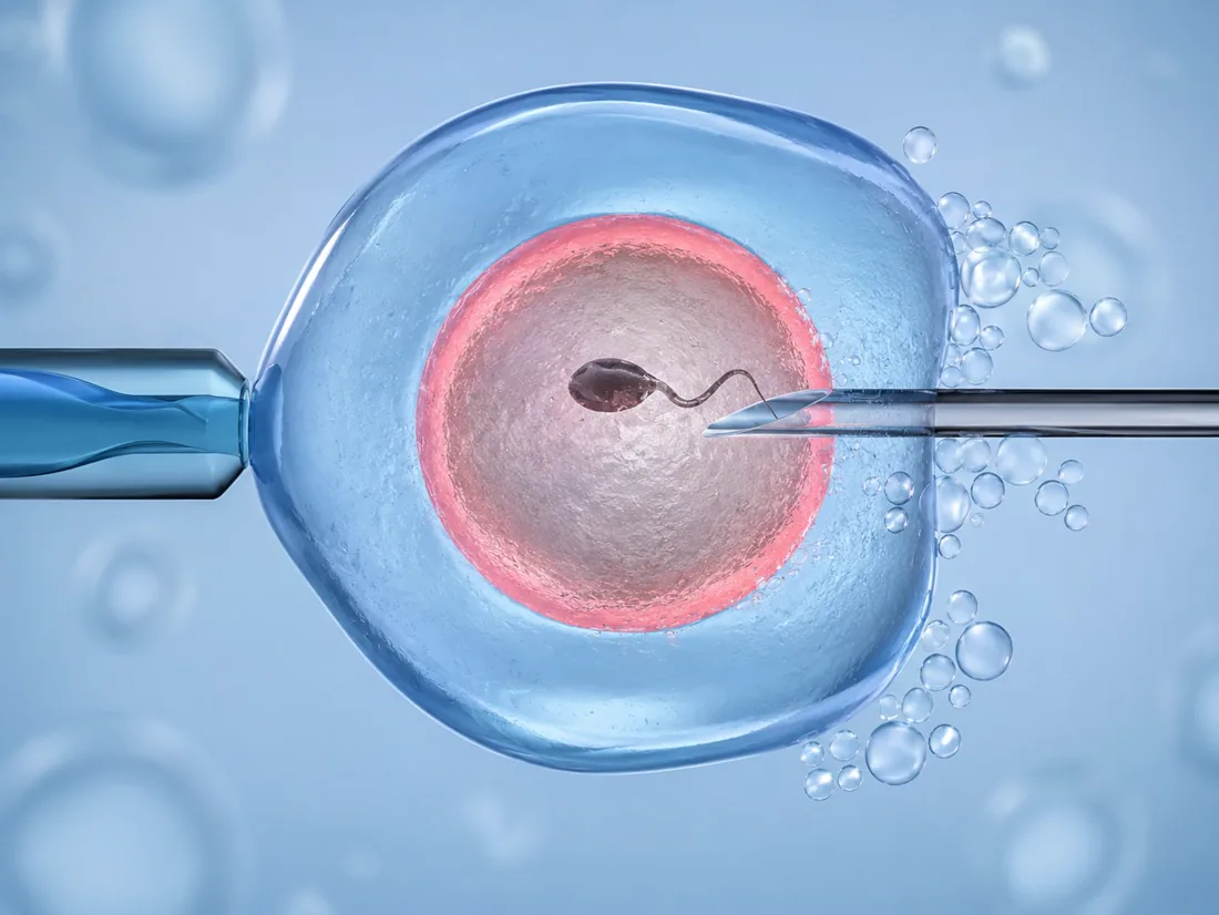 Infertility care